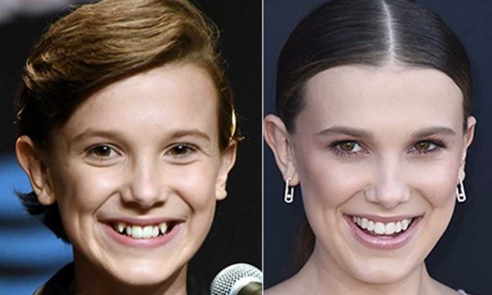 Millie Bobbie Brown Braces and now - FLOK LIFE